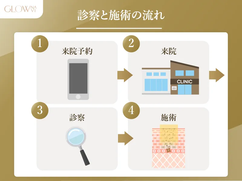 メンズ　シミ取り 施術の流れ